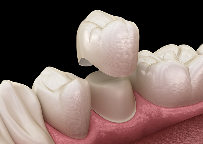 Animated smile demonstrating dental crown restorative dentistry treatment