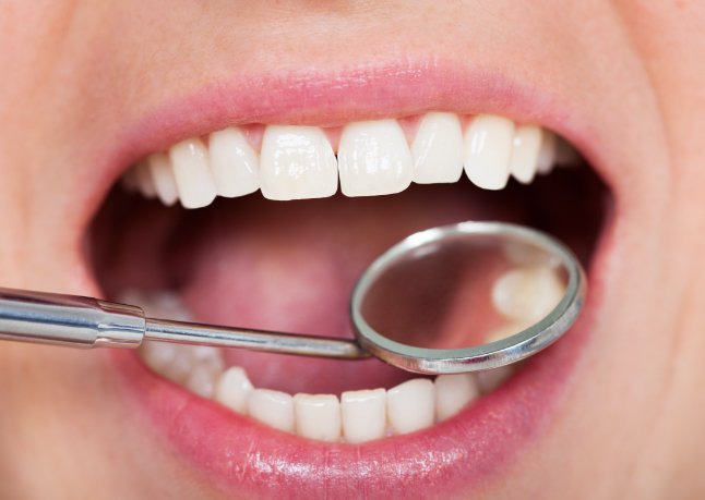 Closeup of smile with tooth colored filling being examined by dentist