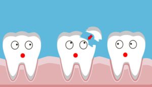 Cartoon image of a chipped tooth.