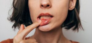 Woman experiencing gum recession 